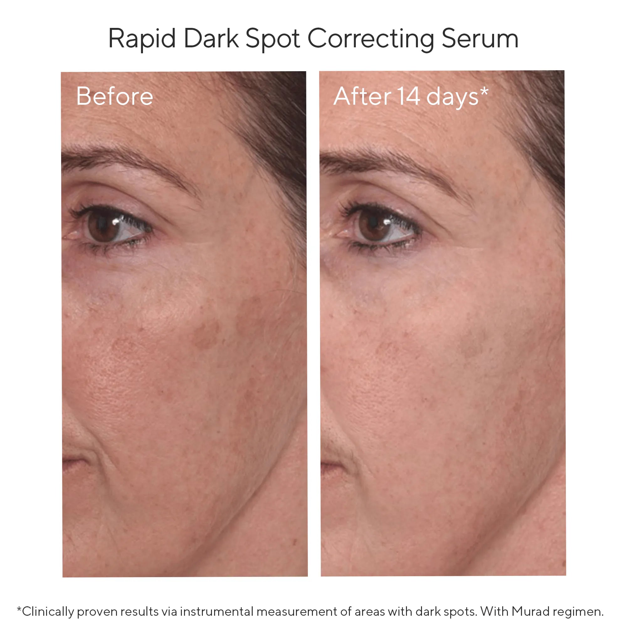 Murad Rapid Dark Spot Correcting Serum, 30ml